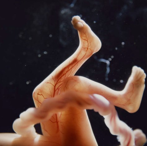 Unborn Baby - 10 weeks old