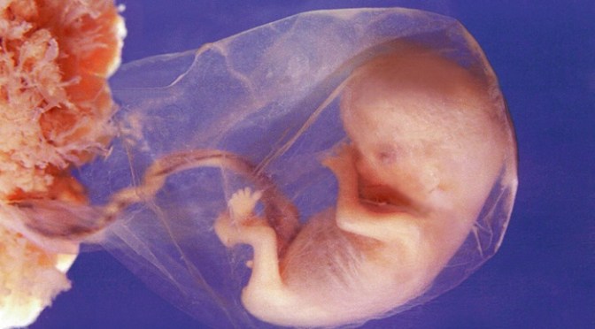 If unborn babies don’t have consciousness or don’t feel pain, may we kill them?