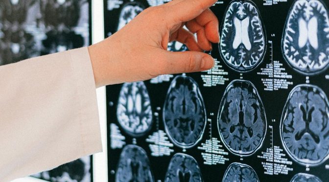 Brain Mind Body Soul Substance Dualism Materialism Physicalism Research Mindfulness